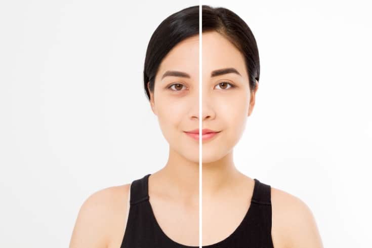 Tiga Contoh Foto Before-After yang Dilarang dalam Regulasi Iklan Medis